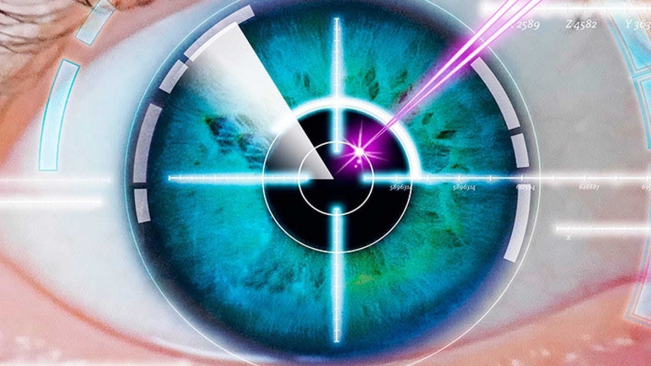 Лазерная коррекция зрения (Миопия, гиперметропия, астигматизм)